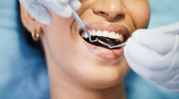 Best Emergency Dentist for Lost Fillings or Crowns in Grifton, NC